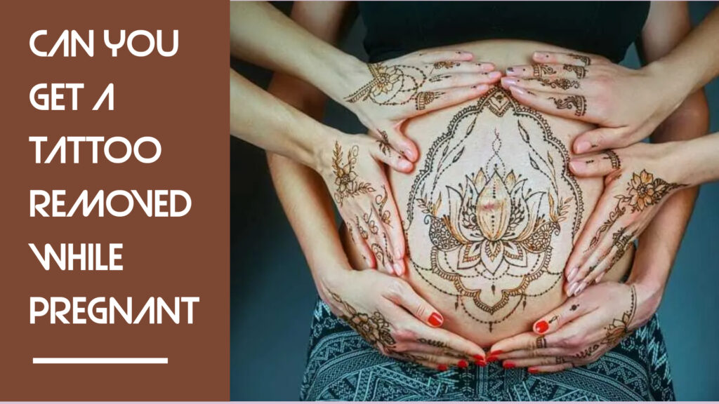 can you get a tattoo removed while pregnant